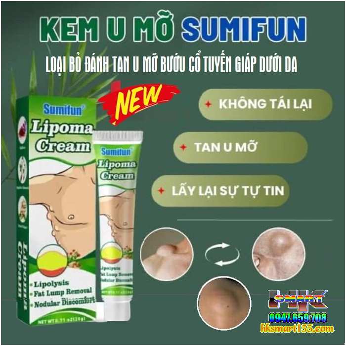 Kem Loại Bỏ Đánh Tan U Mỡ Bướu Cổ Tuyến Giáp Dưới Da Sumifun Lipoma Lipolysis 20gr