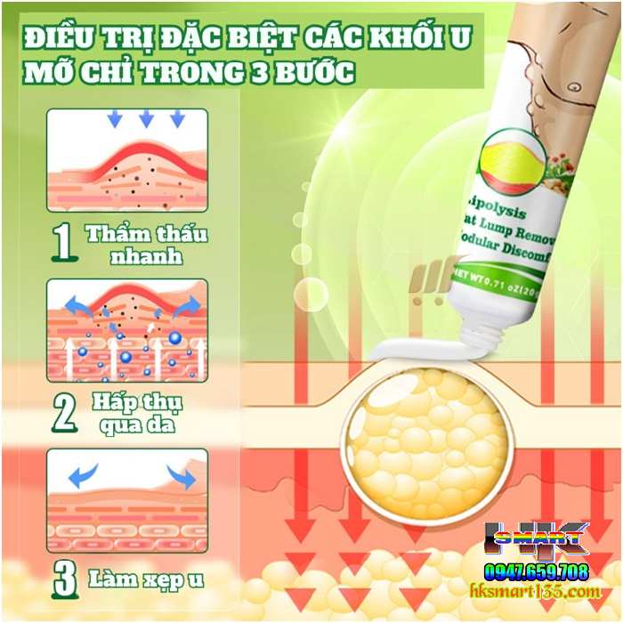 Kem Loại Bỏ Đánh Tan U Mỡ Bướu Cổ Tuyến Giáp Dưới Da Sumifun Lipoma Lipolysis 20gr