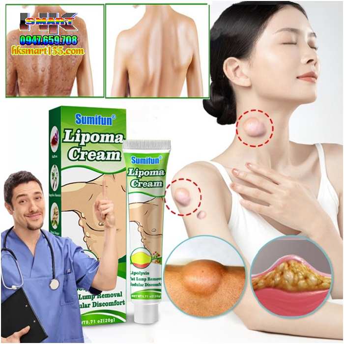 Kem Loại Bỏ Đánh Tan U Mỡ Bướu Cổ Tuyến Giáp Dưới Da Sumifun Lipoma Lipolysis 20gr