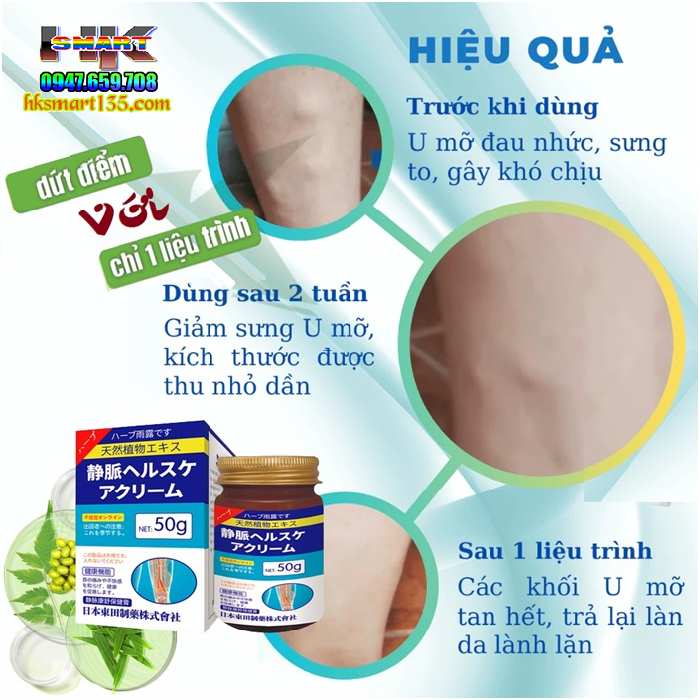 Kem Tan U Tuyến Giáp Senjoko Nhật Bản 50gr - Kem Tan Tuyến Giáp, Cường Giáp Hiệu Quả