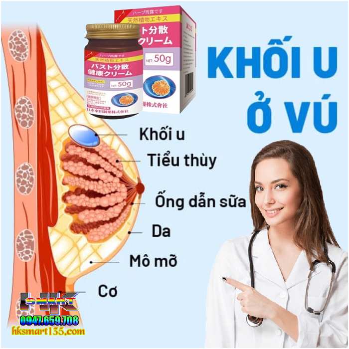 Kem Tan U Bướu Tuyến Vú, Tiêu Nang Senjoko Nhật Bản 50gr- Hỗ Trợ Hiệu Quả U Mỡ, Bướu Hạch, U Xơ Tuyến Vú