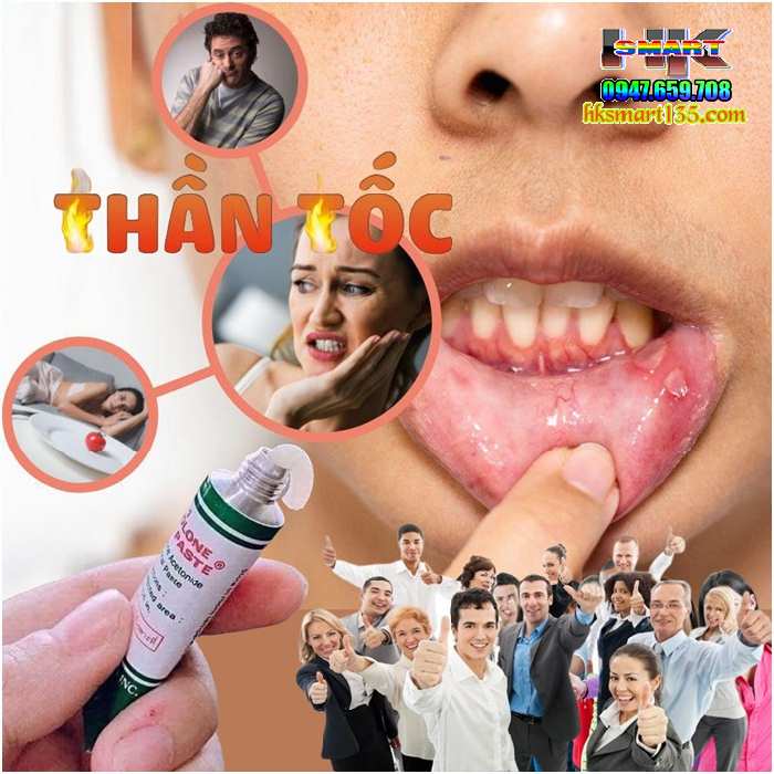 Kem Thoa Nhiệt Miệng Trinolone Oral Paste- Nida Thái Lan