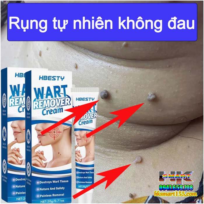 Kem Loại Bỏ Mụn Nám Tàn Nhang