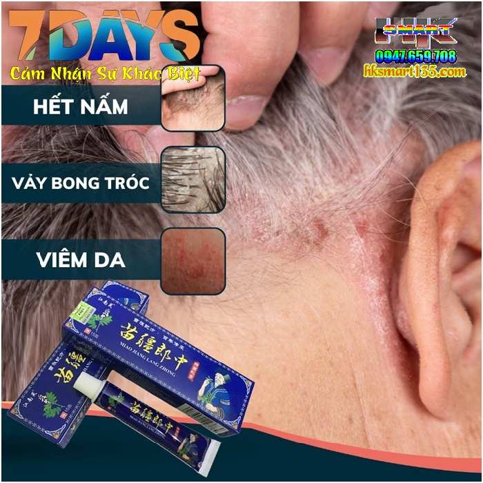 Kem Xanh Đại Phu Đặc Hiệu Trị Các Bệnh Ngoài Da- Nấm, Ngứa, Ghẻ, Hắc Lào...