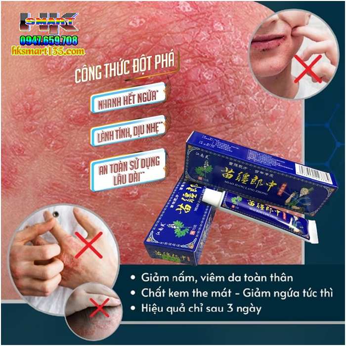 Kem Xanh Đại Phu Đặc Hiệu Trị Các Bệnh Ngoài Da- Nấm, Ngứa, Ghẻ, Hắc Lào...