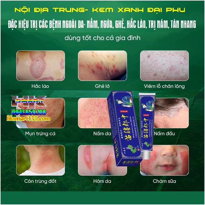 Kem Xanh Đại Phu Đặc Hiệu Trị Các Bệnh Ngoài Da- Nấm, Ngứa, Ghẻ, Hắc Lào...