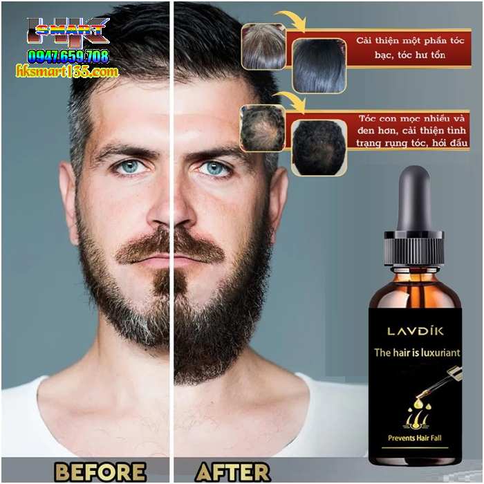 Lavdík Hair Growth Serum Kích Mọc Râu Tóc Đen Dày Bóng Khỏe Giảm Gãy Rụng