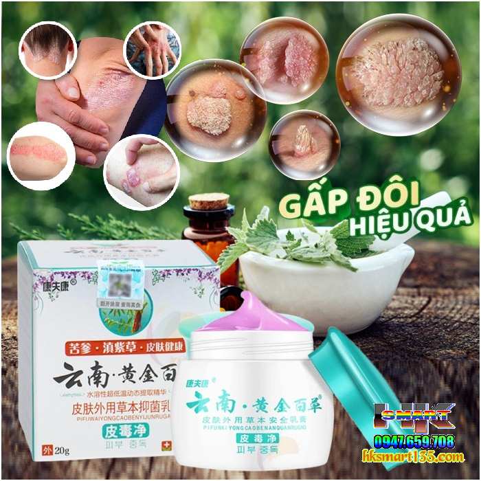Nấm Kim Vương Vân Nam Trung Hoa- Kem Bôi Nấm Ngứa Hỗ Trợ Hắc Lào, Vẩy Nến, Á Sừng, Lang Ben