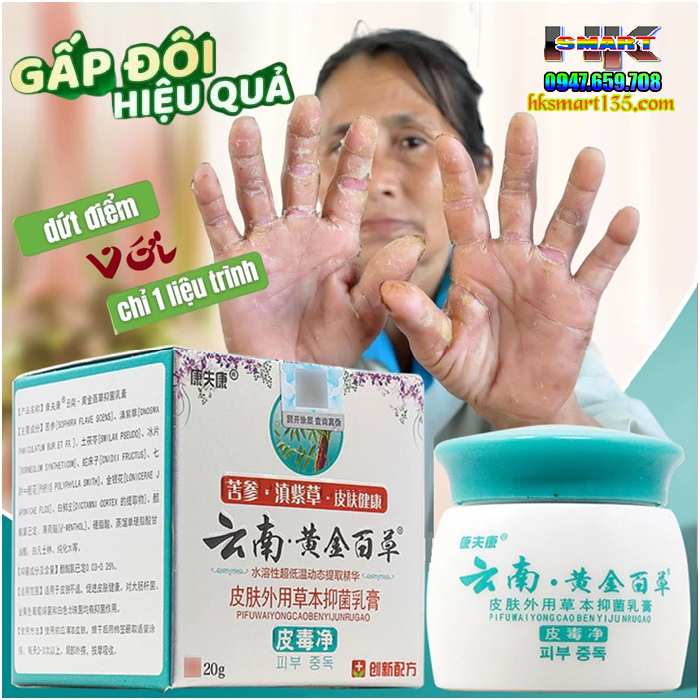 Nấm Kim Vương Vân Nam Trung Hoa- Kem Bôi Nấm Ngứa Hỗ Trợ Hắc Lào, Vẩy Nến, Á Sừng, Lang Ben