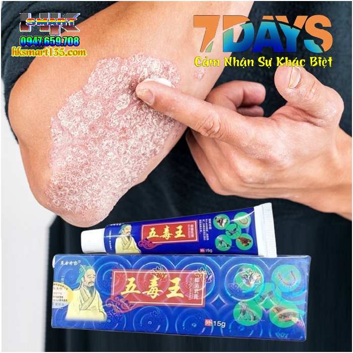 Kem Bôi Đặc Trị Viêm Da Cơ địa, Á Sừng, Vảy Nến Thần Y Hoa Đà
