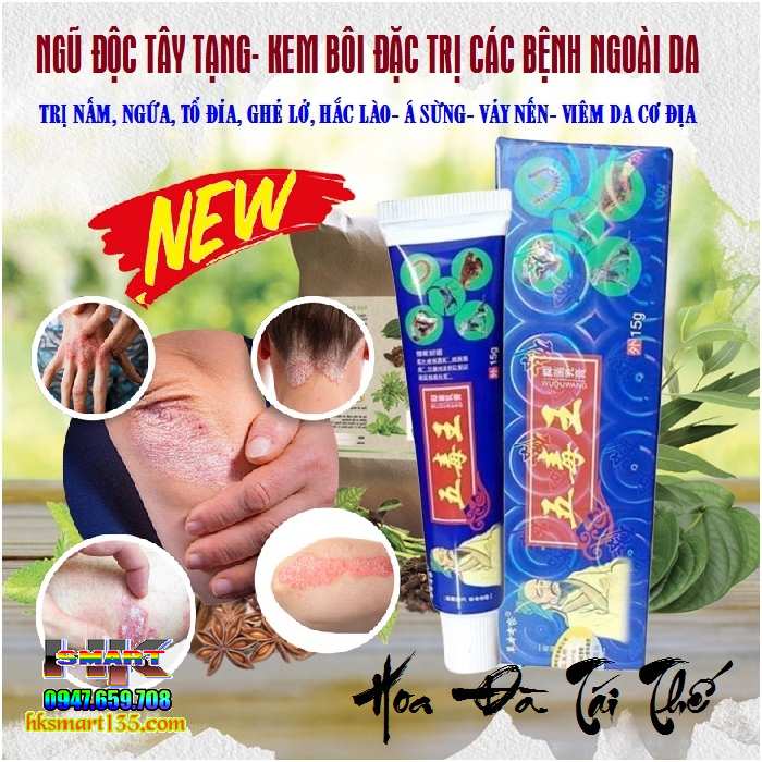 Kem Bôi Đặc Trị Viêm Da Cơ địa, Á Sừng, Vảy Nến Thần Y Hoa Đà