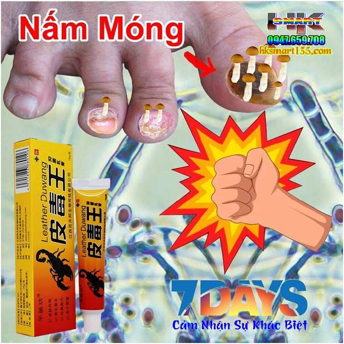 Kem Bọ Cạp Đen Thảo Mộc Trị Nấm Da Móng Tay Chân 15gr
