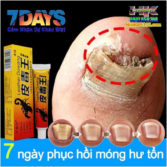 Kem Bọ Cạp Đen Thảo Mộc Trị Nấm Da Móng Tay Chân 15gr