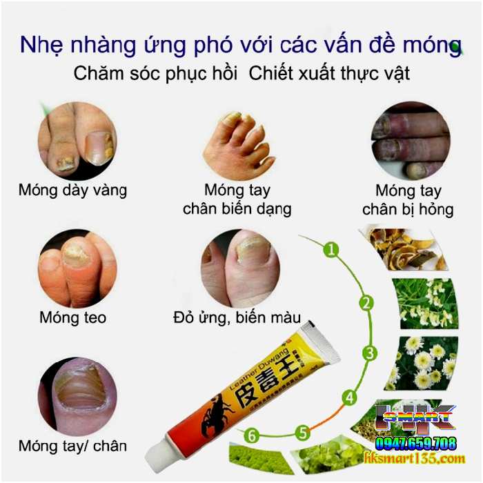 Kem Bọ Cạp Đen Thảo Mộc Trị Nấm Da Móng Tay Chân 15gr