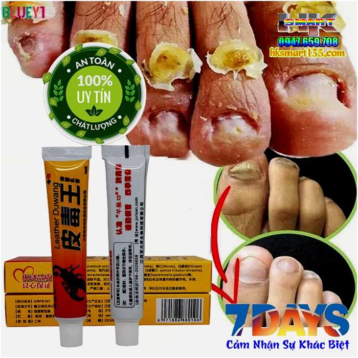Kem Bọ Cạp Đen Thảo Mộc Trị Nấm Da Móng Tay Chân 15gr