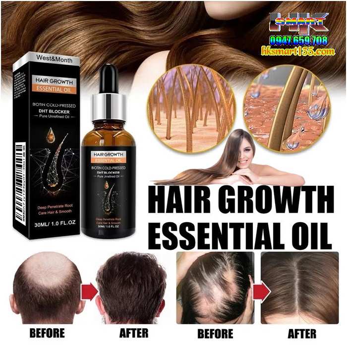 Serum Mọc Tóc Dht Biotin Original Kích Mọc Tóc Đen Dày Bóng Khỏe Giảm Gãy Rụng