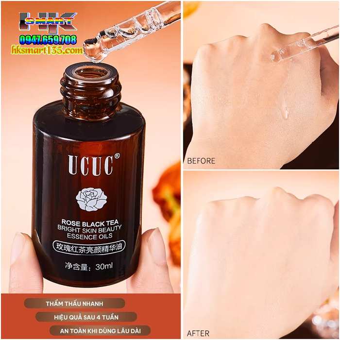 Serum Ucuc Rose Black Tea 30ml- Tinh Chất Trẻ Hóa Làn Da, Chống Lão Hóa, Tăng Độ Đàn Hồi, Giảm Nếp Nhăn