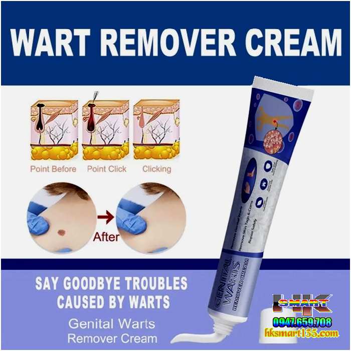 Kem Loại Bỏ Mụn Ruồi South Moon Wart Remoal Cream