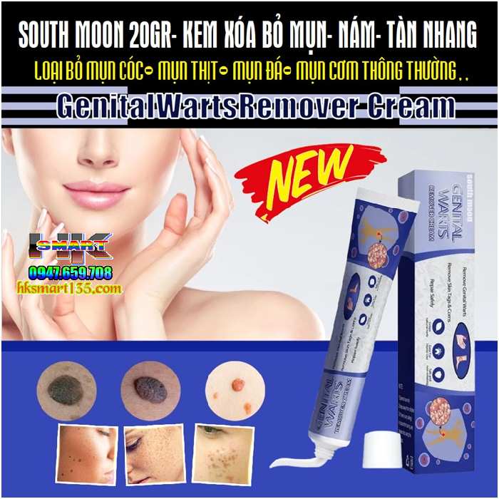 Kem Loại Bỏ Mụn Ruồi South Moon Wart Remoal Cream