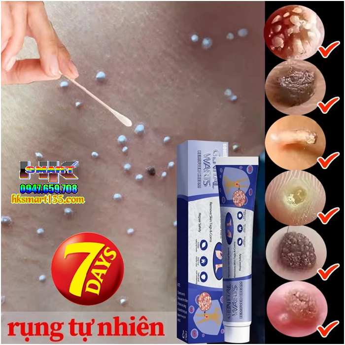 Kem Loại Bỏ Mụn Ruồi South Moon Wart Remoal Cream