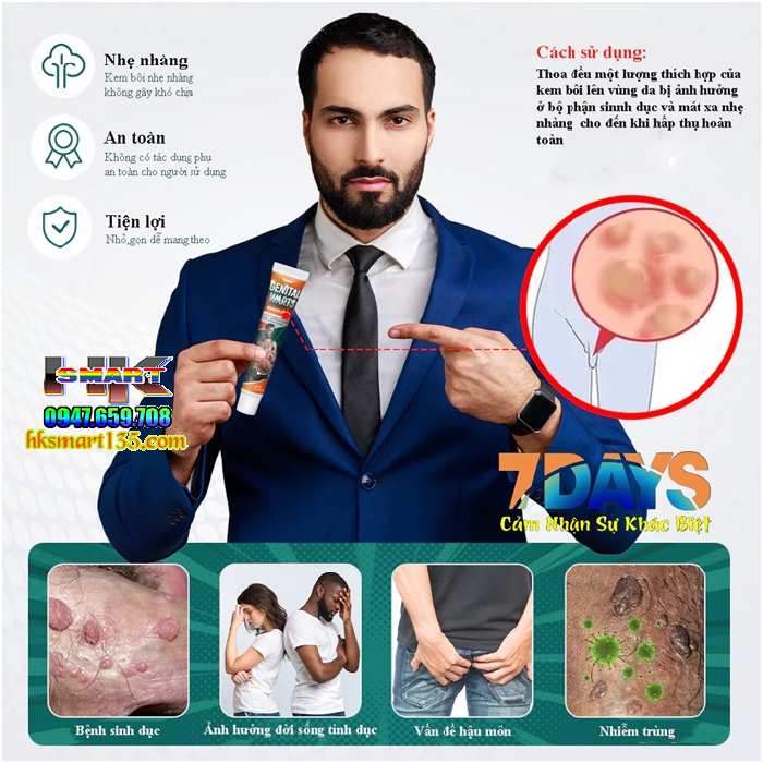 Genital Warts Sumifun- Kem Bôi Da Liễu Nẫm Ngứa Vùng Sinh Dục Do Mụn Sùi Mào Gà nhiễm Hp