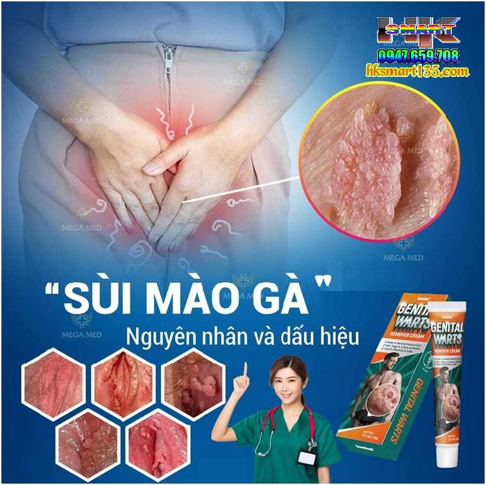 Sumifun 20gr- Kem Bôi Da Liễu Nam Nữ Bôi Nẫm Ngứa Vùng Sinh Dục Do Mụn Sùi Mào Gà nhiễm Hpv