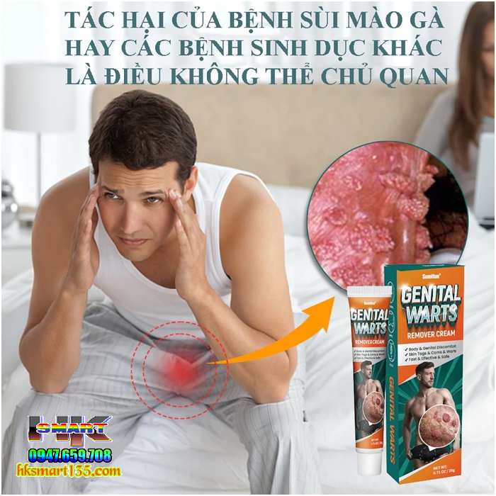 Genital Warts Sumifun- Kem Bôi Da Liễu Nẫm Ngứa Vùng Sinh Dục Do Mụn Sùi Mào Gà nhiễm Hp