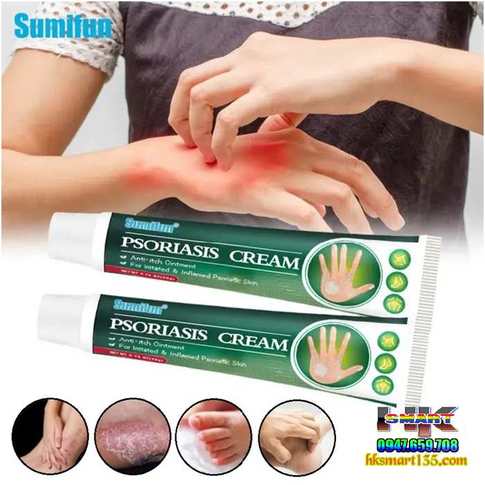 Kem Bôi Psoriasis Ointment Sumifun 20gr- Đặc Trị Các Bệnh Nấm Ngứa Vảy Nến Á Sừng