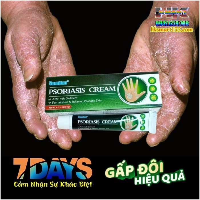 Kem Bôi Psoriasis Ointment Sumifun 20gr- Đặc Trị Các Bệnh Nấm Ngứa Vảy Nến Á Sừng