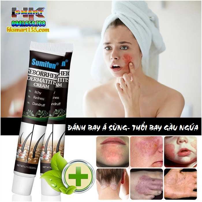 Kem bôi trị Nấm Ngứa, Vẩy Nến, Á Sừng...Chống Gàu Điều Trị Da Đầu Viêm Da Tiết Bã