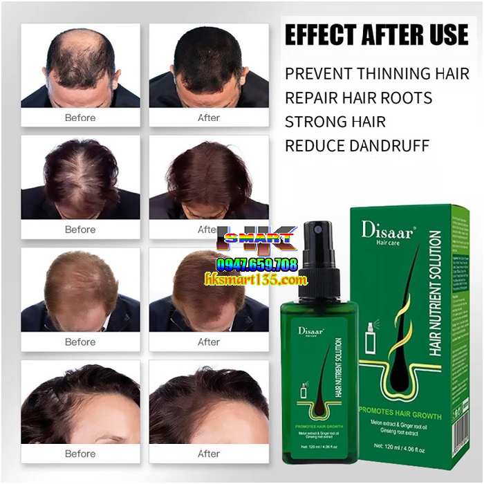 Tinh chất xịt mọc tóc Hair Nutrient Solution120ml