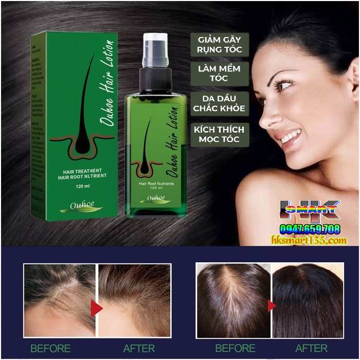 Xịt Dưỡng Kích Thích Mọc Tóc Ouhoe Hair Lotion 120ml