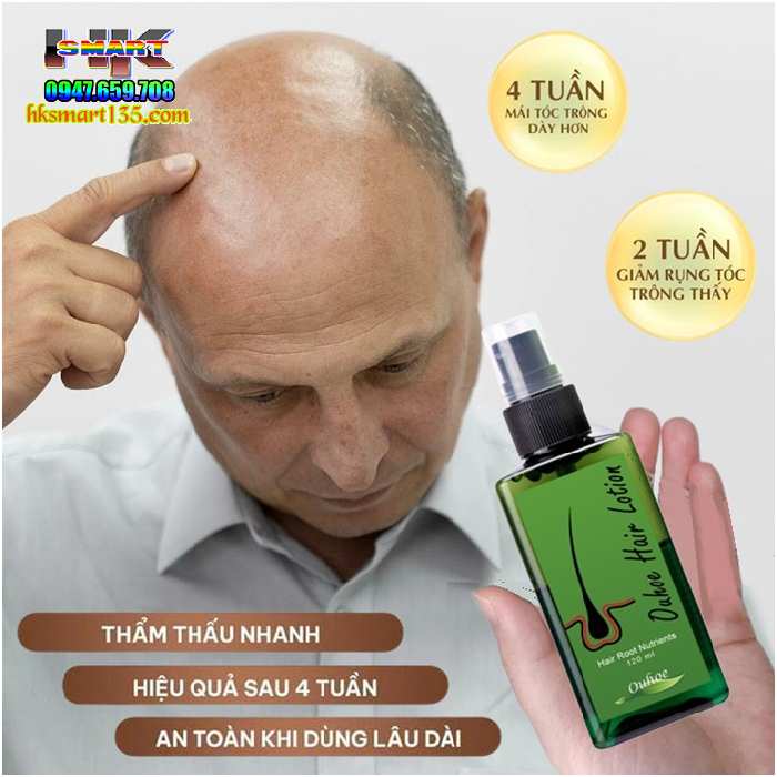 Xịt Dưỡng Kích Thích Mọc Tóc Ouhoe Hair Lotion 120ml