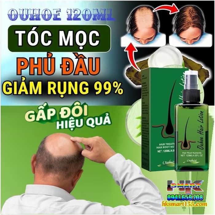 Xịt Dưỡng Kích Thích Mọc Tóc Ouhoe Hair Lotion 120ml