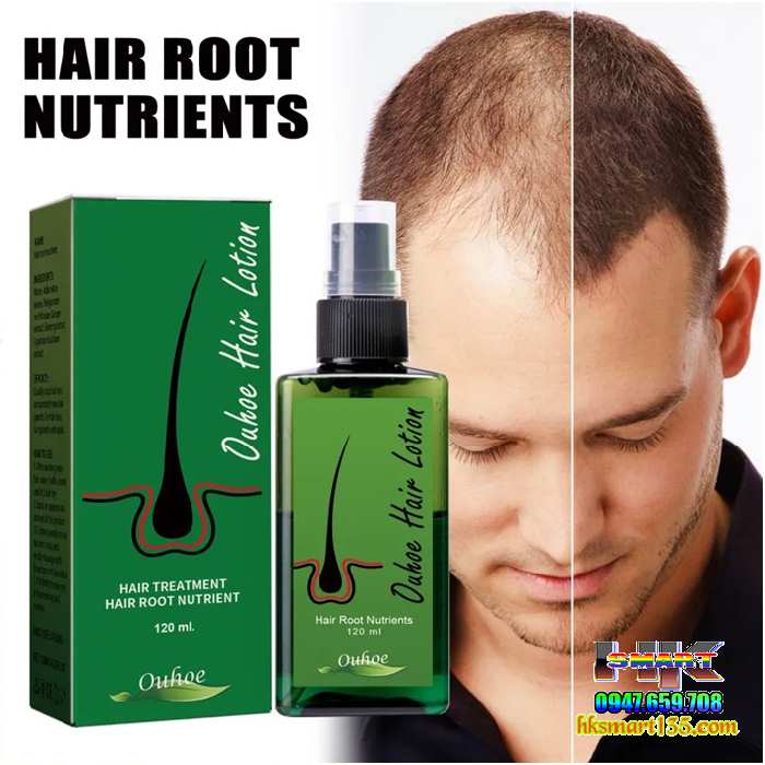 Thuốc xịt mọc tóc Neo Hair Lotion 120ml