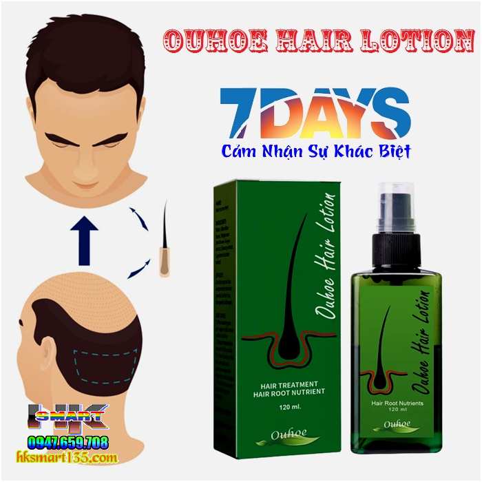 Thuốc xịt mọc tóc Neo Hair Lotion 120ml