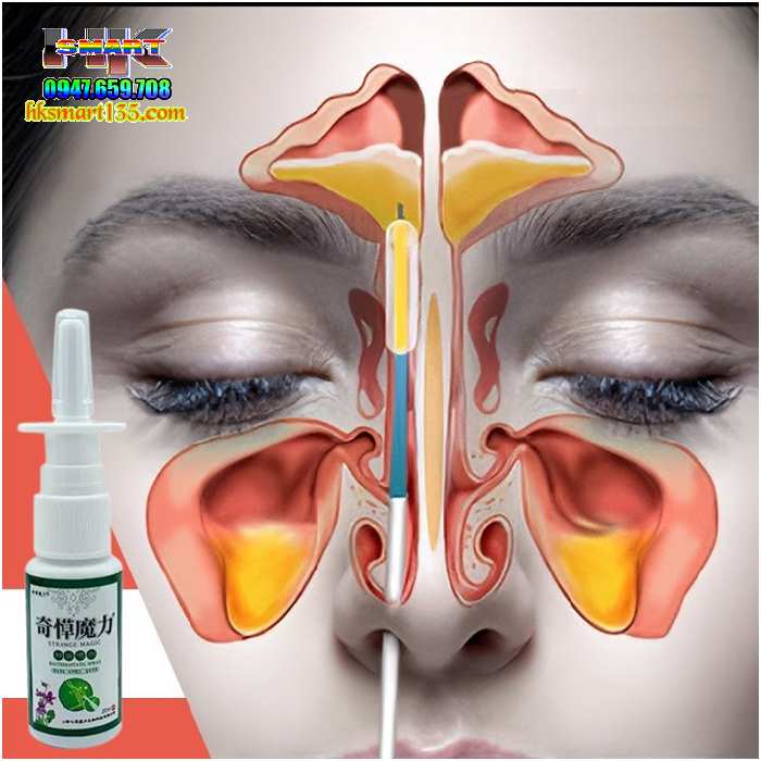 Xịt Xoang Mũi Strange Magic Hỗ Trợ Giảm Các Bệnh Lý Hô Hấp