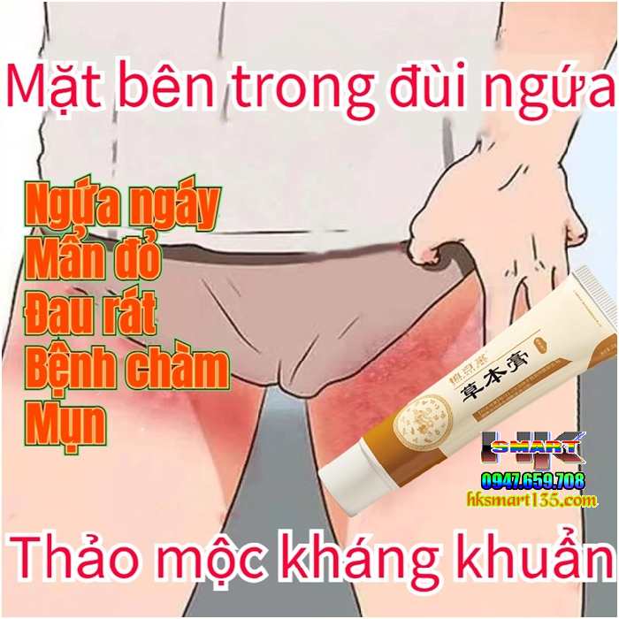 Kem bôi đặc trị viêm da cơ địa, á sừng, vảy nến Zhibaido