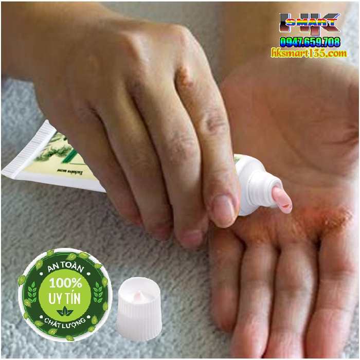 ZUDAIFU 15GR- Kem bôi đặc trị nấm ngứa, nứt nẻ, nấm móng tay chân