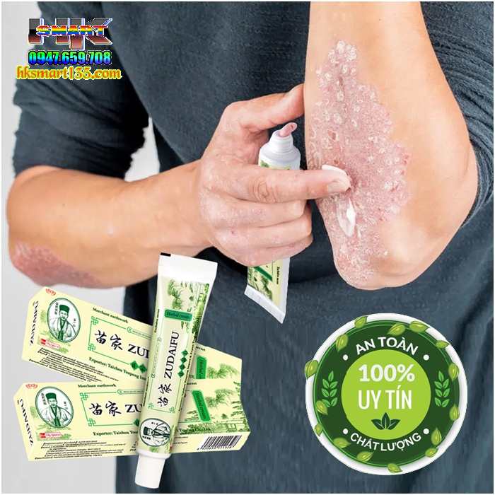 ZUDAIFU 15GR- Kem bôi đặc trị nấm ngứa, nứt nẻ, nấm móng tay chân