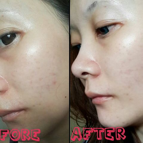 Kem Dưỡng Se Khit Lỗ Chan Long Skin Refining Treatment Sk Ii 50g Kem Dưỡng Se Khit Lỗ Chan Long Skin Refining Treatment Sk Ii 50g