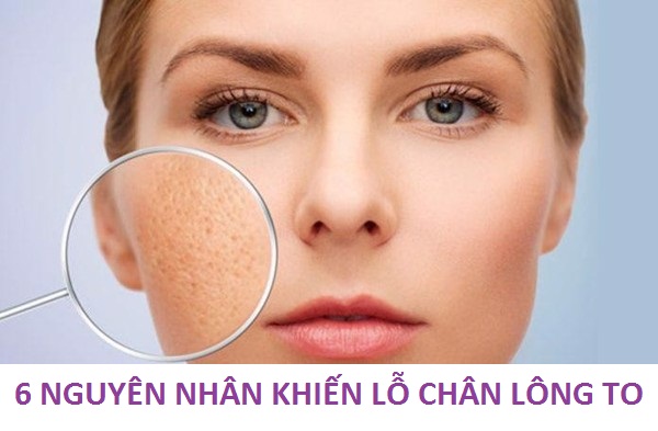 Tất tật các nguyên nhân dẫn đến tình trạng lỗ chân lông to