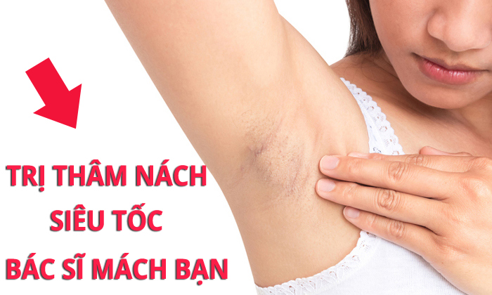 5 MẸO TRỊ THÂM NÁCH SIÊU TỐC -  BÁC SĨ MÁCH BẠN