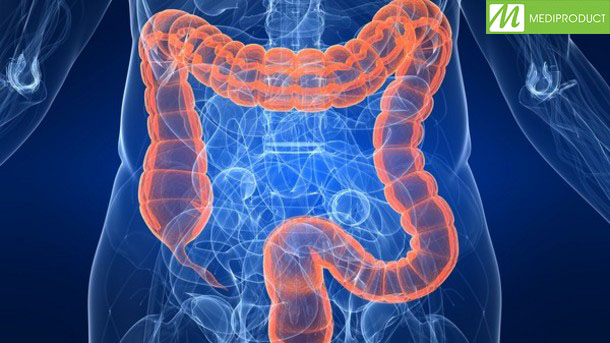 Điểm danh những nguyên nhân gây nên hội chứng ruột kích thích IBS