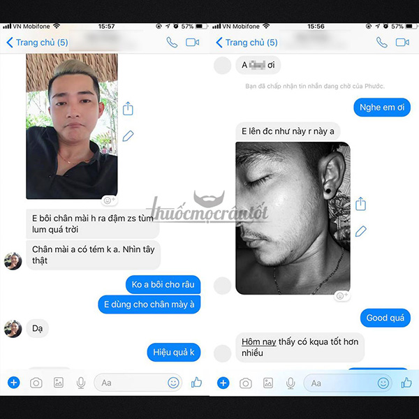 Thuốc mọc râu minoxidil 5 - 1