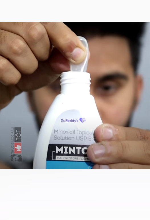 Minoxidil 10% Mintop