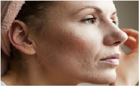 Da mất nước - làm sao cấp nước đủ cho tế bào da