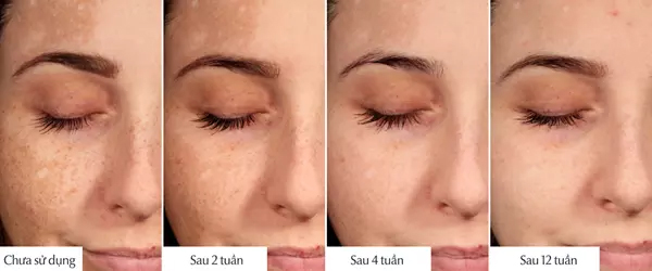 hieu qua su dung cua eucerin spot corrector