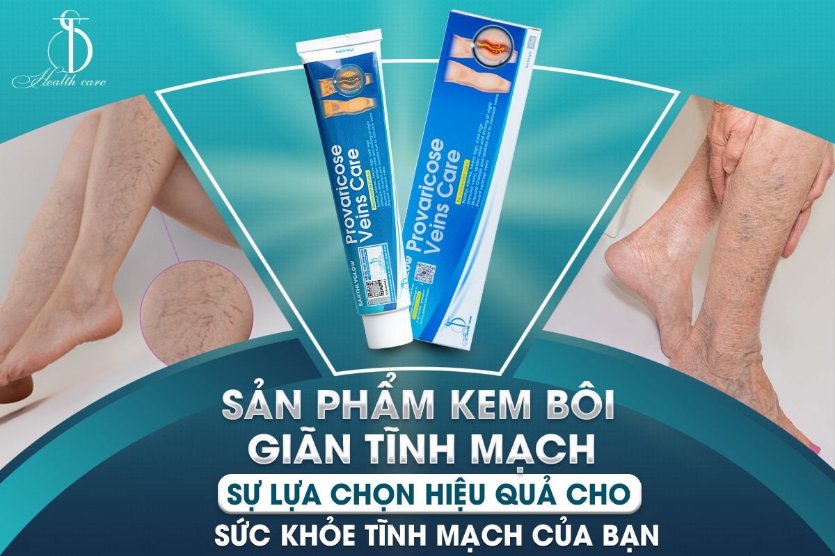 Provaricose – Kem hỗ trợ cải thiện tình trạng chân bị giãn tĩnh mạch