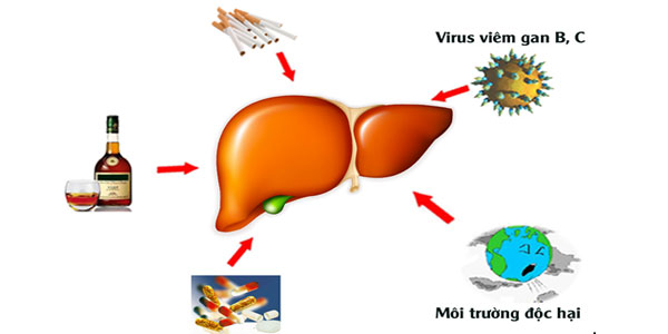 Nguyên nhân khiến gan bị nóng, nhiễm độc